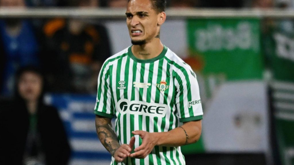 Tira y afloja por Antony