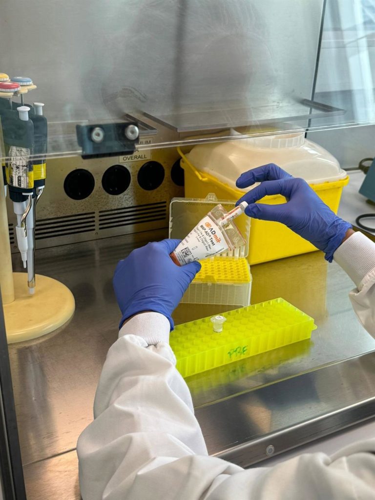 Desarrollan "el primer biomarcador en sangre" que anticipa la progresión hacia el Alzheimer