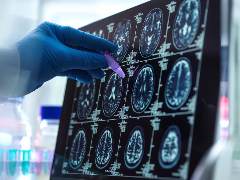 El 89% de los expertos cree que la falta de tiempo en consulta dificulta el diagnóstico temprano del Alzheimer