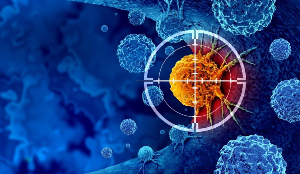 Inmunoterapia antes y después de la cirugía podría mejorar el tratamiento del mesotelioma