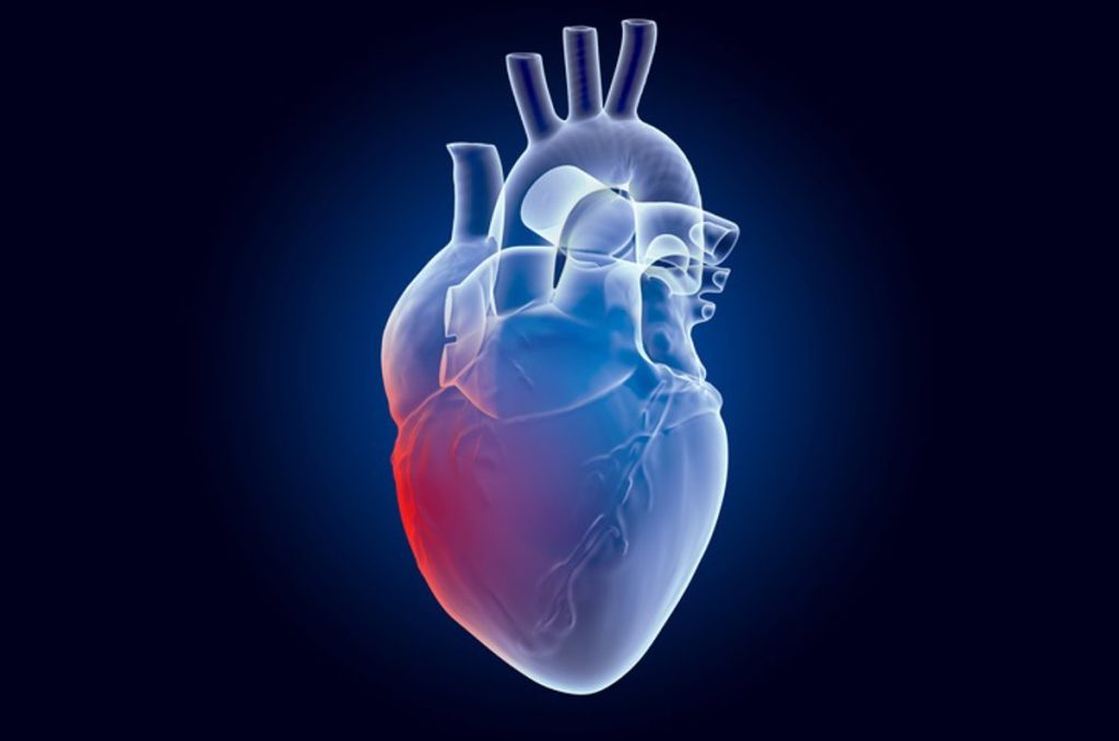 ¿Qué causa los ataques cardíacos en adultos jóvenes si no es la placa arterial?